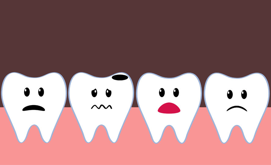 What Can Cause a Toothache? | Southview Dentistry | Charlotte, NC