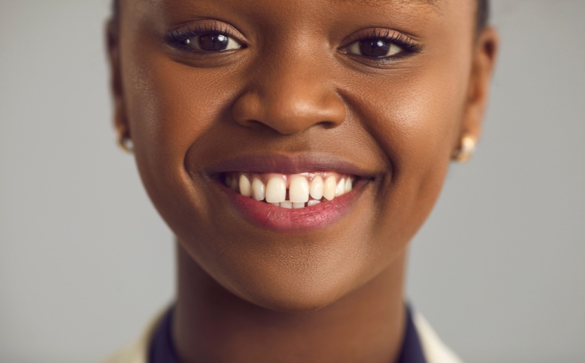 diastema case study